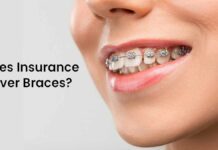 Can Insurance Cover Braces