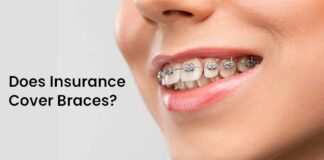 Can Insurance Cover Braces