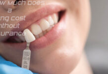 How Much Does a Filling Cost Without Insurance