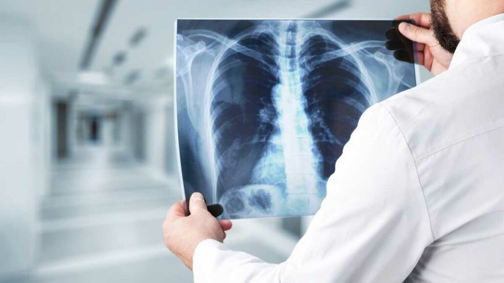 How Much are X Rays Without Insurance