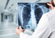How Much are X Rays Without Insurance